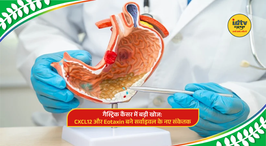 Microscopic view of gastric cancer cells highlighting biomarkers CXCL12 and eotaxin in medical research