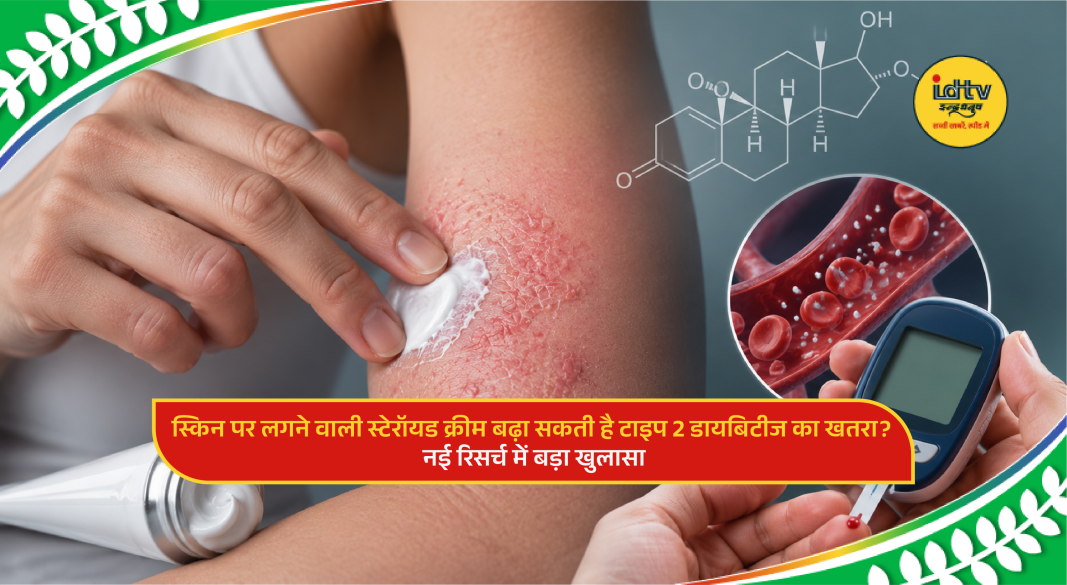 Doctor applying topical steroid cream on skin while highlighting diabetes risk in medical research study