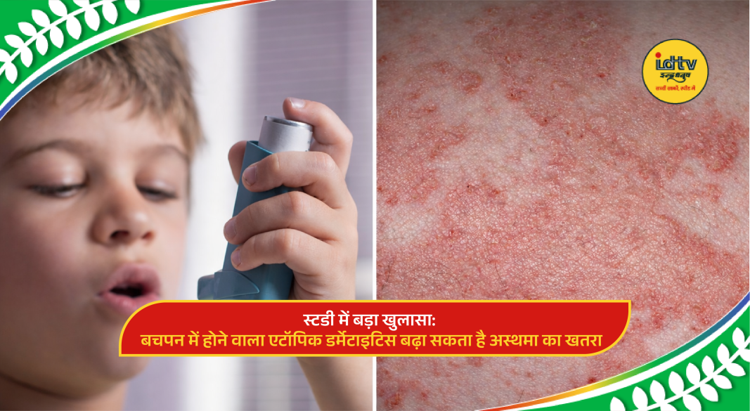 Child with skin rash from atopic dermatitis using inhaler, highlighting asthma risk connection