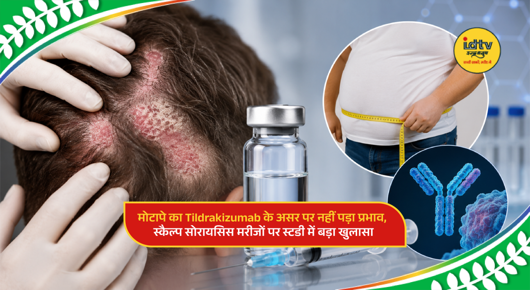 Doctor examining scalp psoriasis patient as study highlights effectiveness of Tildrakizumab in obese patients