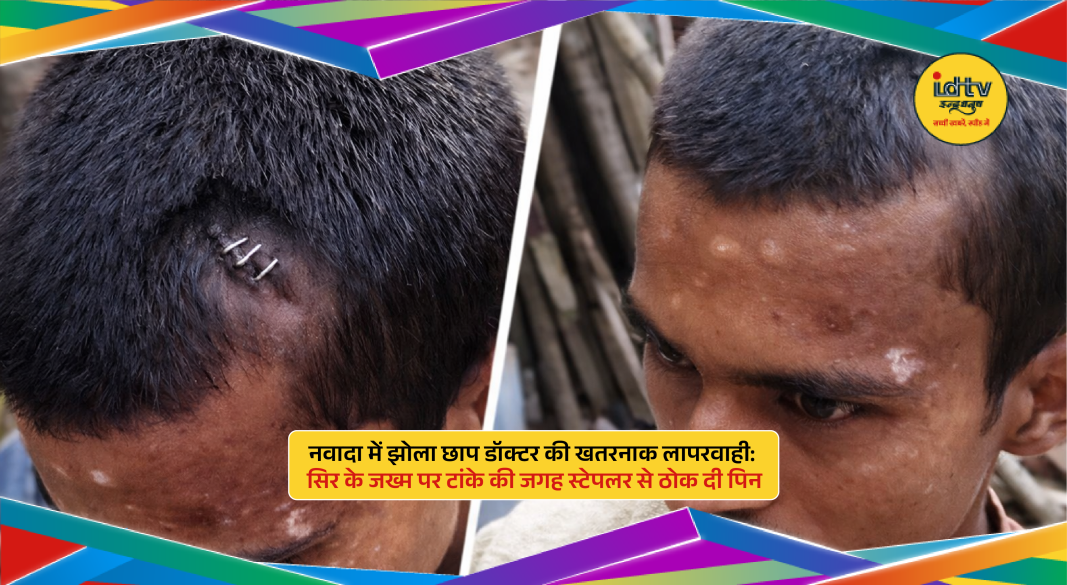 fraud doctor in Nawada used a stapler instead of medical stitches on a patient’s head wound.