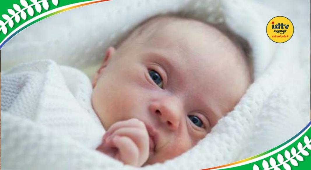 Down syndrome symptoms