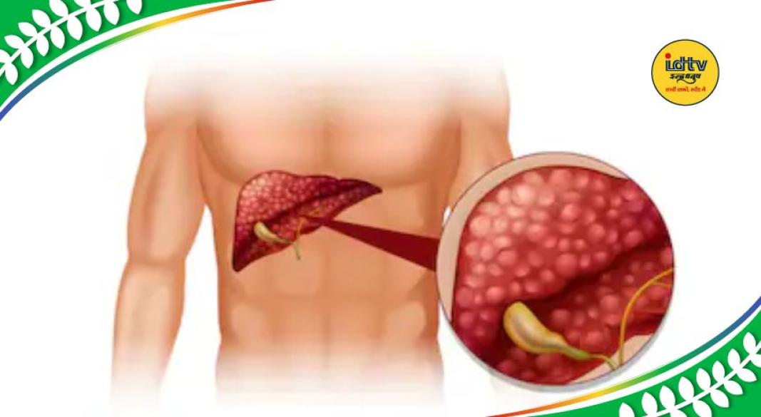 Sugary Drinks Risk