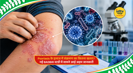 Doctor consulting psoriasis patient while discussing infection risks linked to systemic therapy treatment