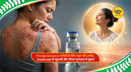 Doctor explaining Dupilumab treatment benefits for Prurigo Nodularis patients suffering from severe itching and skin lesions.